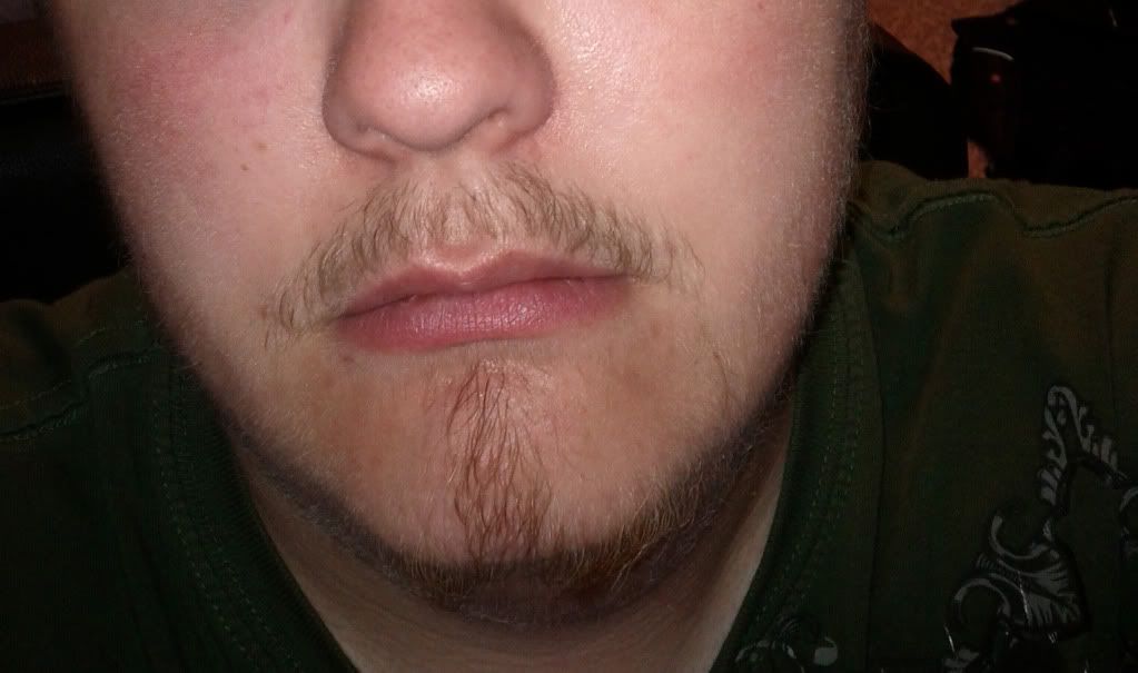 Facial hair not growing Facial hair not growing have hit